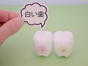 白い歯にする方法